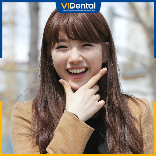 Răng thỏ thường thể hiện sự dễ thương