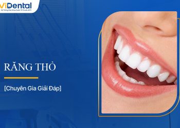 Răng Thỏ: Đẹp Hay Xấu? Tất Tần Tật Thông Tin Bạn Cần Biết