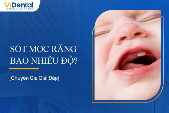 Sốt Mọc Răng Bao Nhiêu Độ? Tất Tần Tật Thông Tin Cho Mẹ