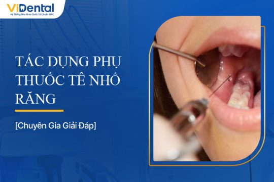 Tác Dụng Phụ Thuốc Tê Nhổ Răng: Những Điều Cần Biết