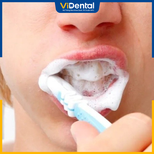 Luôn giữ vệ sinh răng miệng sạch sẽ